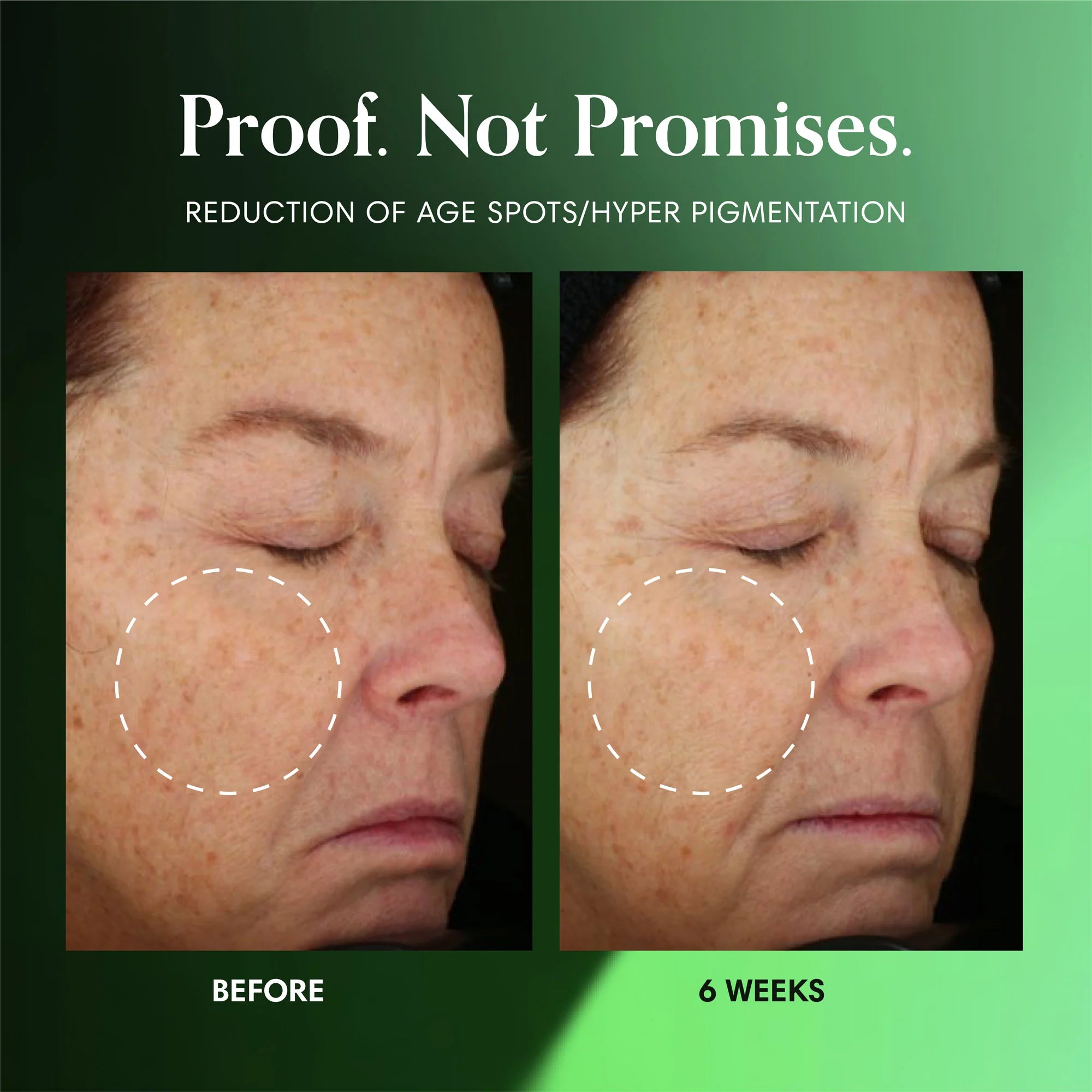 Advanced Peptide Line Corrector