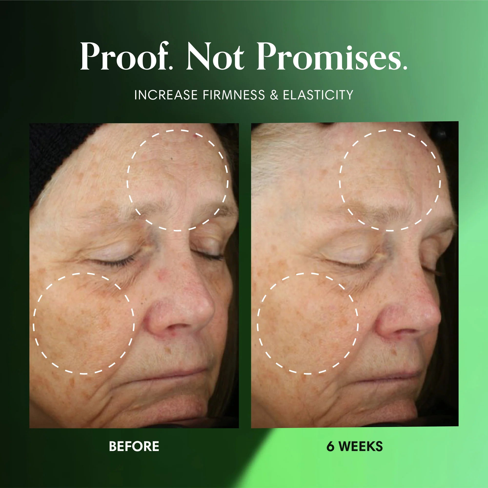 Advanced Peptide Line Corrector